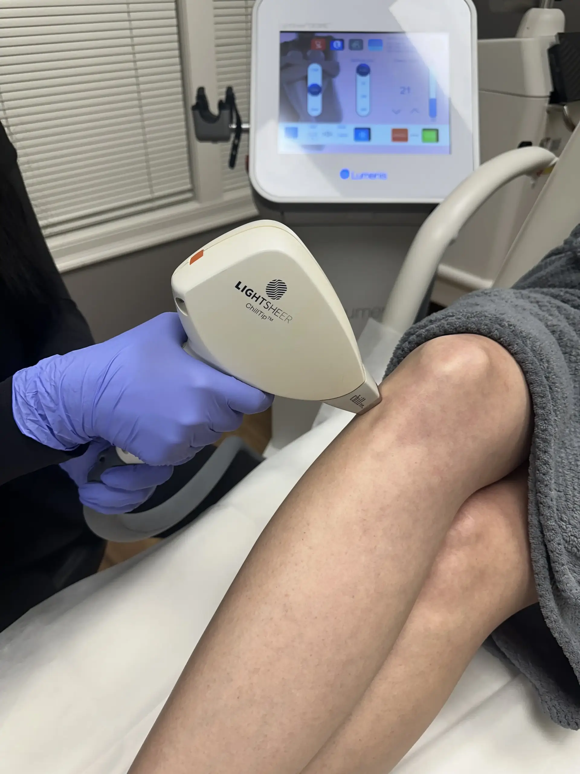 a person getting laser hair removal in Northborough, MA
