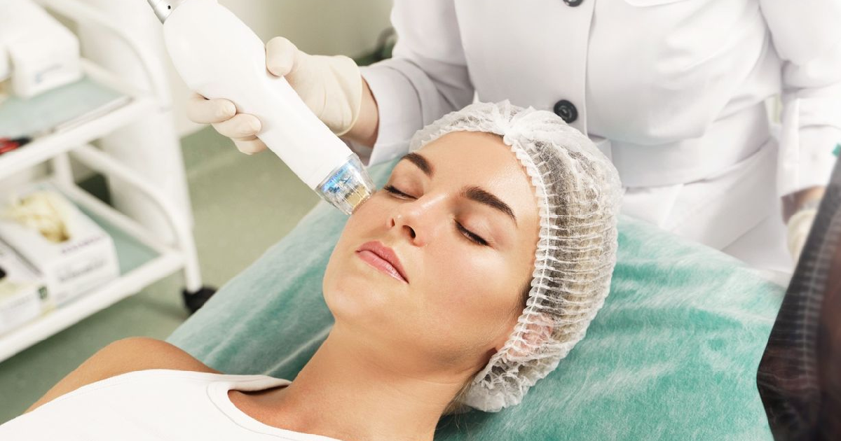 Woman receiving RF MICRONEEDLING WITH INFINI™ in Northborough, MA for skin rejuvenation and youthful glow.