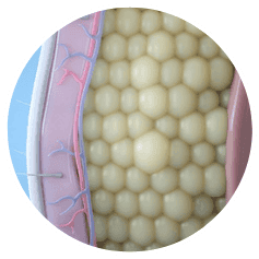 CoolSculpting in Northborough, MA