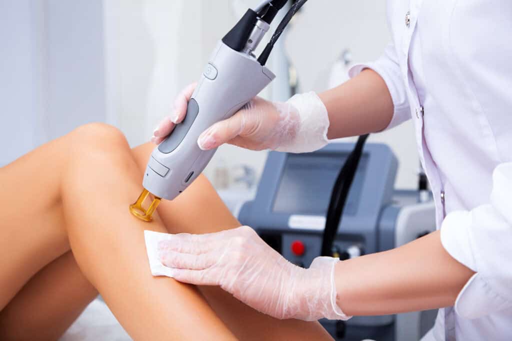 Laser Hair Removal by Concentus LLC