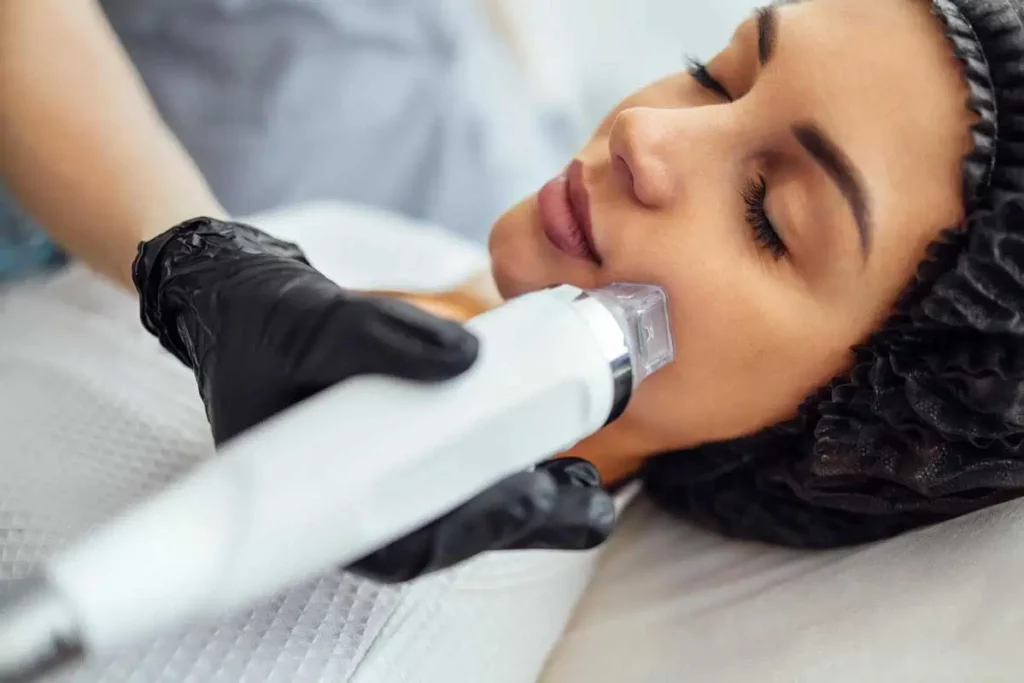 RF Microneedling-Concentus LLC -Northborough