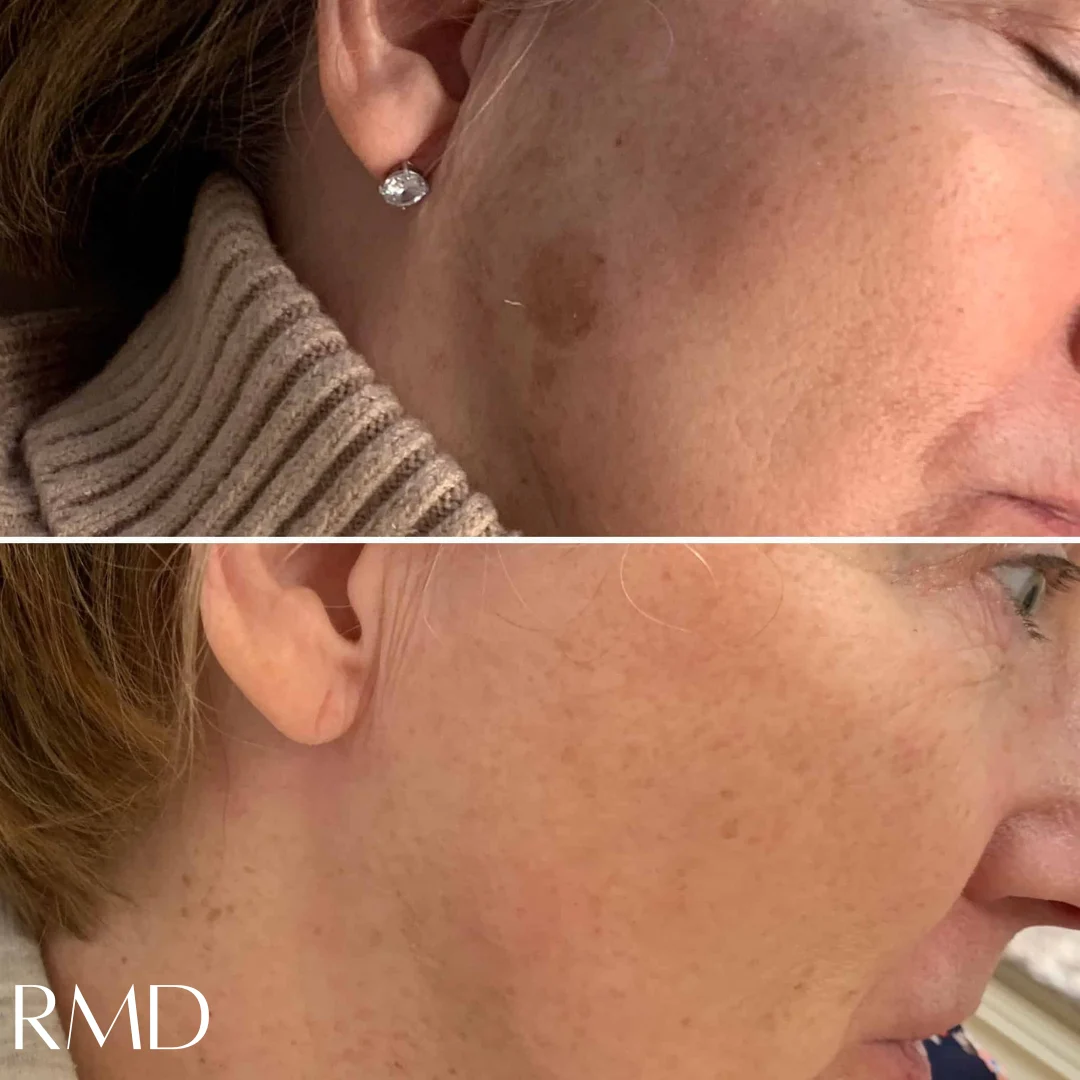 a collage of a woman's face in Northborough, MA