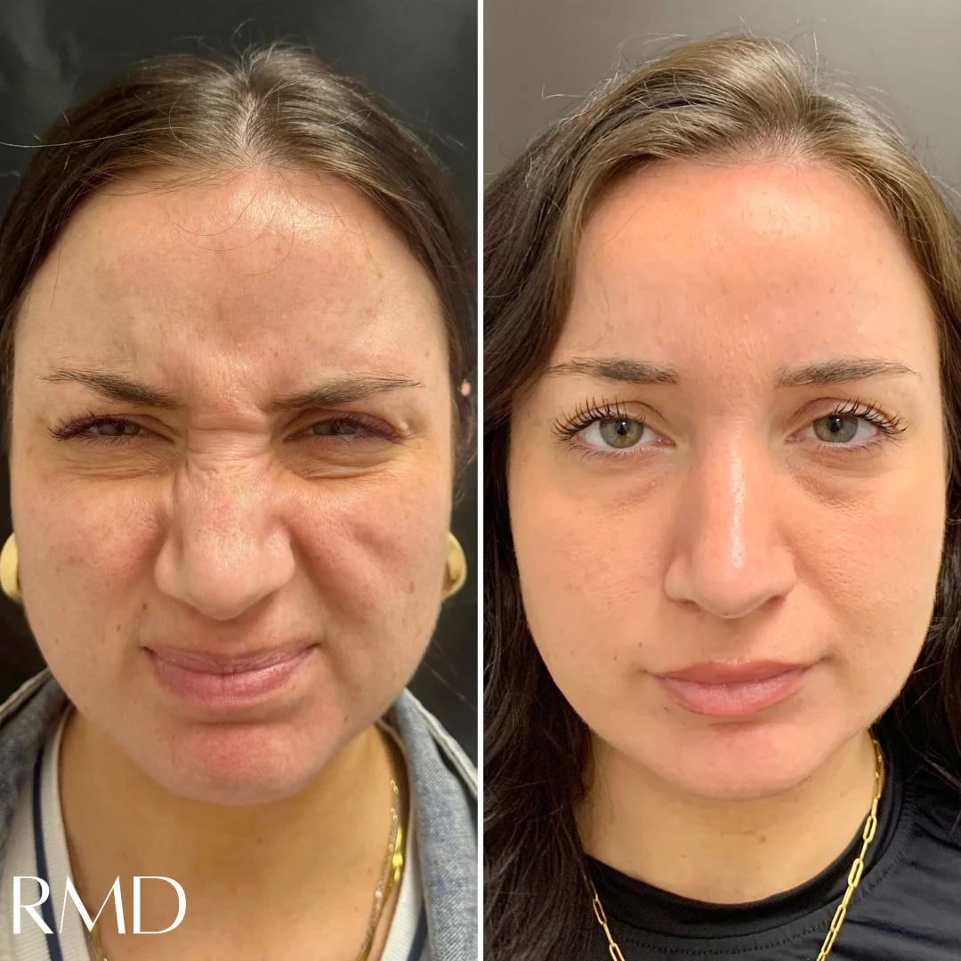 a collage of a woman's face Comparing in Northborough, MA