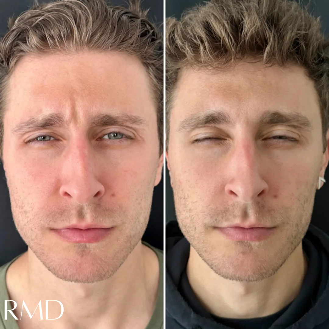 Man comparing his skin in Northborough, MA