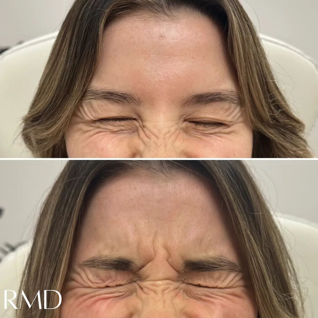 A woman comparing her before and after hair in Northborough, MA