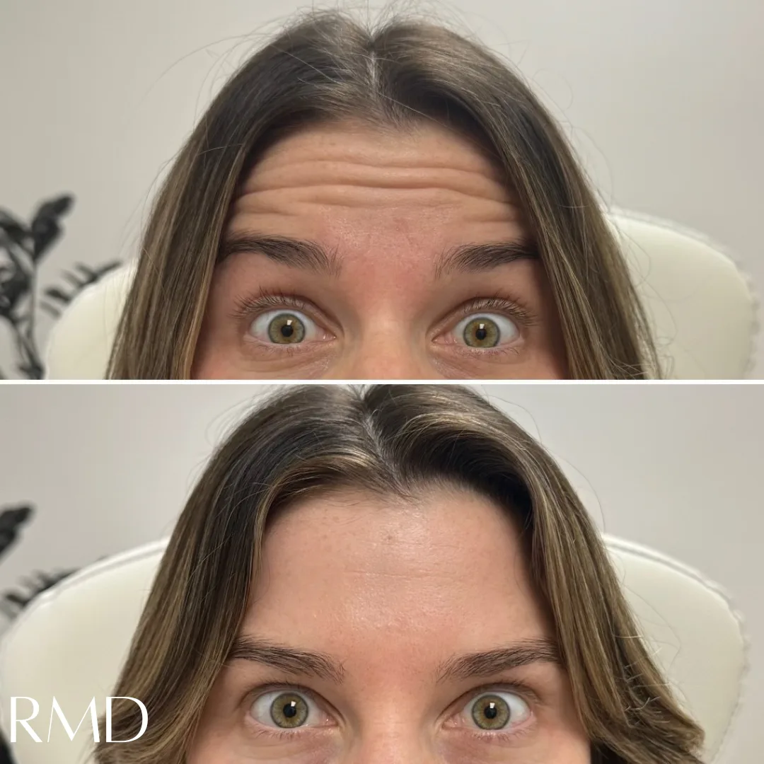 A woman comparing her before and after hair in Northborough, MA