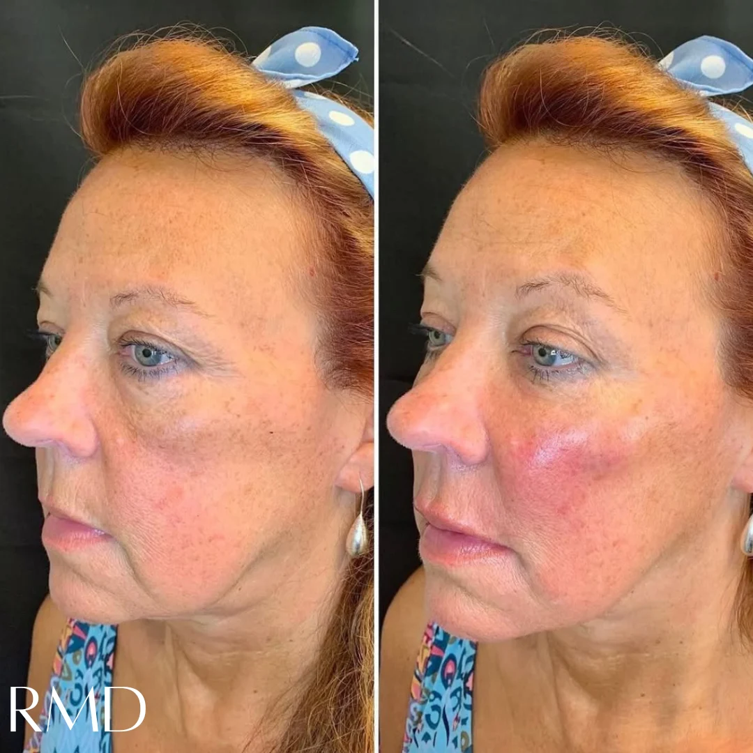 a woman with before and after image in Northborough, MA