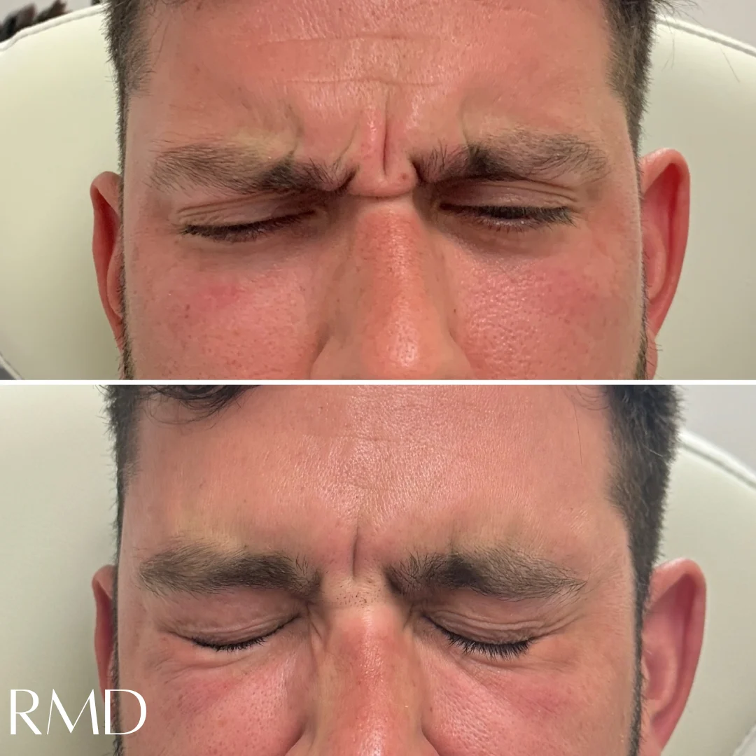 a close up of a woman's face comparing in Northborough, MA