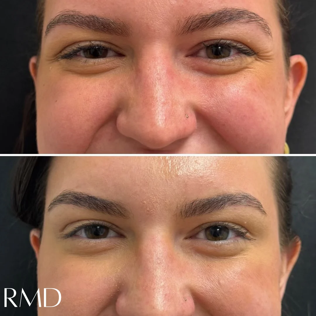 a close up of a woman's face comparing in Northborough, MA