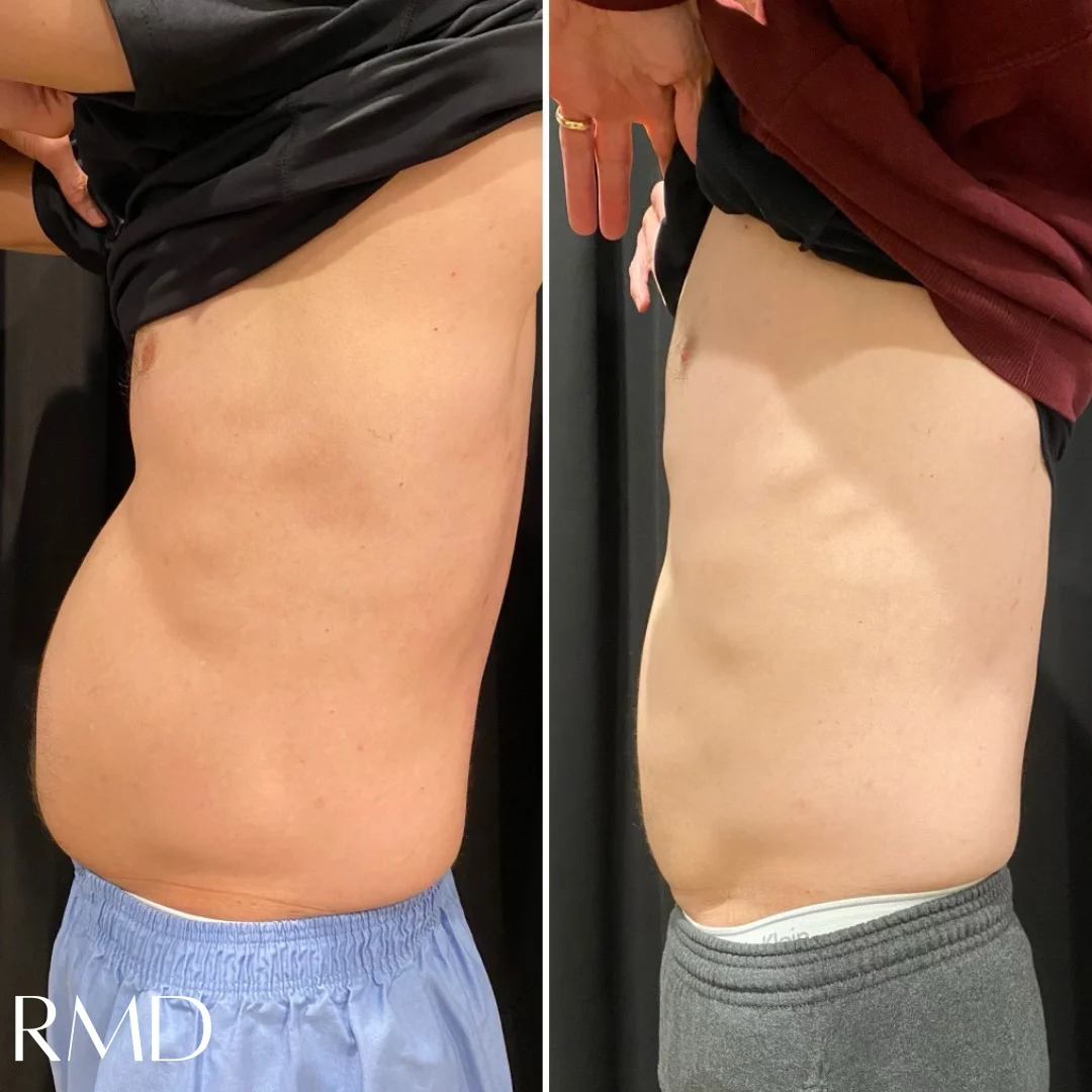 a comparison of a man's body in Northborough, MA